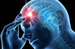 2025 09 10 La carga invisible de la migraña